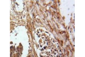#VALUE! (Inhibin alpha 抗体  (AA 25-363))