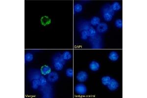 Immunofluorescence staining of mouse splenocytes using anti-MHC I antibody R1-21. (Recombinant MHC, Class I 抗体)