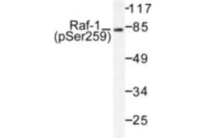 Image no. 1 for anti-V-Raf-1 Murine Leukemia Viral Oncogene Homolog 1 (RAF1) (pSer259) antibody (ABIN318109) (RAF1 抗体  (pSer259))