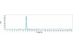 anti-RTN4 (Ozanezumab Biosimilar) antibody