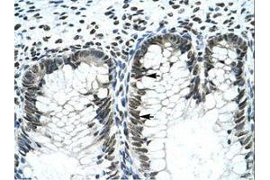 Image no. 3 for anti-GLI Family Zinc Finger 2 (GLI2) (AA 600-649) antibody (ABIN202982) (GLI2 抗体  (AA 600-649))