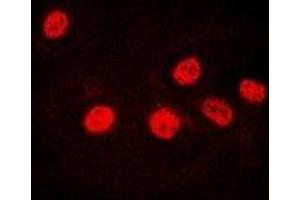 Immunofluorescent analysis of Ikaros staining in U2OS cells. (IKZF1 抗体)