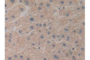 Detection of PK2 in Human Liver Tissue using Polyclonal Antibody to Prokineticin 2 (PK2) (PROK2 抗体  (AA 30-128))