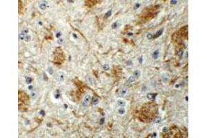 Immunohistochemical staining of mouse brain cells with LCMT2 polyclonal antibody  at 5 ug/mL. (LCMT2 抗体  (N-Term))