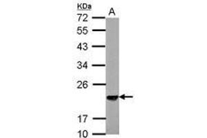Image no. 2 for anti-S-Phase Kinase-Associated Protein 1 (SKP1) (AA 1-163) antibody (ABIN1500944) (SKP1 抗体  (AA 1-163))