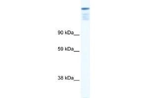 WB Suggested Anti-ZFP106 Antibody Titration: 0. (ZFP106 抗体  (N-Term))