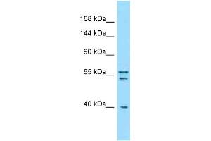 Western Blotting (WB) image for anti-Piccolo (Presynaptic Cytomatrix Protein) (PCLO) (C-Term) antibody (ABIN2789740) (PCLO 抗体  (C-Term))