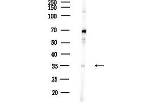 anti-Myristoylated Alanine-Rich Protein Kinase C Substrate (MARCKS) (pSer159) antibody