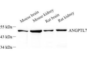 Western blot analysis of Angptl7 (ABIN7073049) at dilution of 1: 500 (ANGPTL7 抗体)