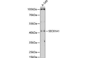 Western blot analysis of extracts of A-549 cells, using SEC61 Antibody (1614) at 1:3000 dilution. (SEC61A1 抗体  (AA 310-420))