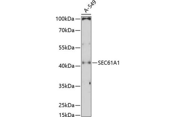 SEC61A1 抗体  (AA 310-420)