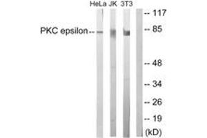 Western blot analysis of extracts from HeLa/Jurkat/3T3 cells, treated with PMA 125ng/ml 30', using PKC epsilon (Ab-729) Antibody. (PKC epsilon 抗体  (AA 688-737))
