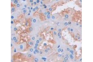 IHC-P analysis of Kidney tissue, with DAB staining. (CMTM1 抗体  (AA 1-286))