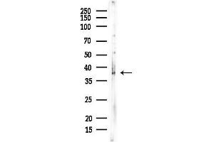 Western blot analysis of lysates from Rat testis, using ELOVL6 Antibody at 1/1000 dilution.