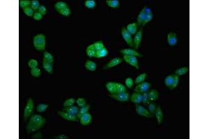 Immunofluorescent analysis of PC-3 cells using ABIN7150725 at dilution of 1:100 and Alexa Fluor 488-congugated AffiniPure Goat Anti-Rabbit IgG(H+L) (MAP2K7 抗体  (AA 17-160))