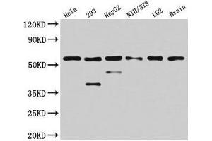 Western Blot Positive WB detected in: Hela whole cell lysate, 293 whole cell lysate, HepG2 whole cell lysate, NIH/3T3 whole cell lysate, LO2 whole cell lysate, Mouse brain tissue All lanes: PKM antibody at 4. (PKM 抗体  (AA 185-461))