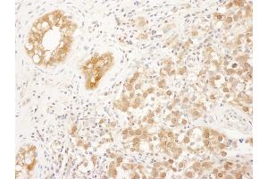 anti-Farnesyltransferase, CAAX Box, alpha (FNTA) (AA 329-379) antibody