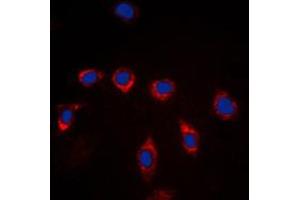 Immunofluorescent analysis of CD157 staining in Raw264. (BST1 抗体  (Center))