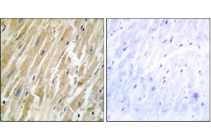 Immunohistochemistry analysis of paraffin-embedded human heart tissue using CALR antibody. (Calreticulin 抗体)