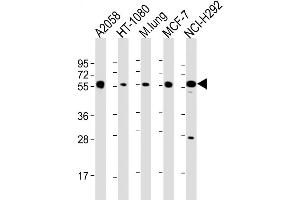 Western Blot at 1:2000 dilution Lane 1: A2058 whole cell lysate Lane 2: HT-1080 whole cell lysate Lane 3: mouse lung lysate Lane 4: MCF-7 whole cell lysate Lane 5: NCI-H292 whole cell lysate Lysates/proteins at 20 ug per lane. (MMP14 抗体  (N-Term))