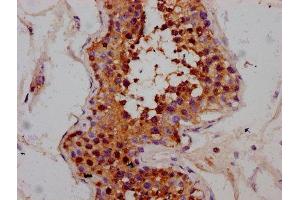 IHC image of ABIN7168374 diluted at 1:300 and staining in paraffin-embedded human testis tissue performed on a Leica BondTM system. (MEX3B 抗体  (AA 253-375))