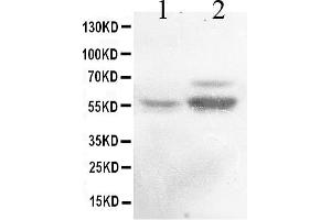 Western blot analysis of ALDH1A2 expression in rat testis extract ( Lane 1) and mouse testis extract ( Lane 2).
