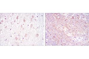 Immunohistochemistry (IHC) image for anti-CD1a (CD1a) antibody (ABIN969017)