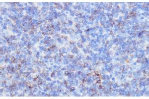 Immunohistochemistry of paraffin-embedded Mouse spleen using NOTCH3 Polyclonal Antibody at dilution of 1:100 (40x lens). (NOTCH3 抗体)