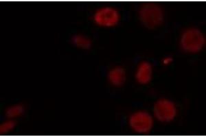 ABIN6274460 staining HeLa cells by IF/ICC. (CELF1 抗体  (N-Term))