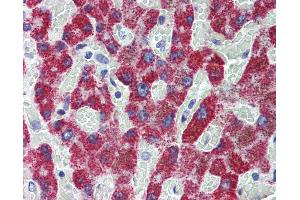 Immunohistochemistry (IHC) image for anti-Acyl-CoA Dehydrogenase, C-2 To C-3 Short Chain (Acads) (AA 1-104) antibody (ABIN574013)