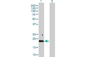 Western Blot analysis of TGFA expression in transfected 293T cell line by TGFA MaxPab polyclonal antibody. (TGFA 抗体  (AA 1-160))