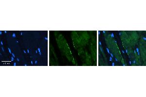 Immunohistochemistry (IHC) image for anti-CLPTM1-Like (CLPTM1L) (Middle Region) antibody (ABIN2783984)