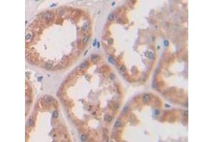 Used in DAB staining on fromalin fixed paraffin- embedded kidney tissue (Parkin 抗体  (AA 229-465))