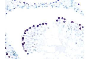 Immunohistochemistry (IHC) image for anti-Histone Acetyltransferase 1 (HAT1) antibody (ABIN7267702)