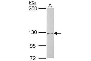 WB Image Sample (30 ug of whole cell lysate) A: Hep G2 , 5% SDS PAGE antibody diluted at 1:500