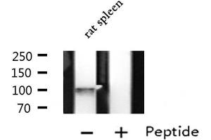 Western blot analysis of extracts from Rat spleen lysate, using LRP8 antibody. (LRP8 抗体  (Internal Region))
