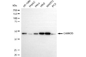 Western blotting analysis using CAMK2D antibody (ABIN7797835). (Recombinant CAMK2D 抗体)