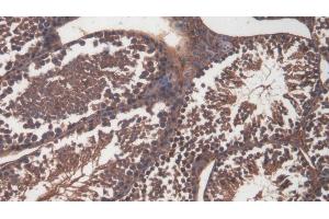 Detection of CD99 in Mouse Testis Tissue using Polyclonal Antibody to Cluster Of Differentiation 99 (CD99) (CD99 抗体  (AA 27-161))