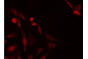 ABIN6267703 staining Hela by IF/ICC. (PRKAB1 抗体  (pSer181))