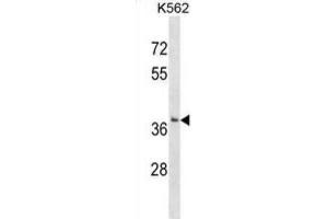 Western Blotting (WB) image for anti-Single-Strand-Selective Monofunctional Uracil-DNA Glycosylase 1 (SMUG1) antibody (ABIN2999446) (SMUG1 抗体)