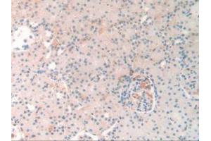 IHC-P analysis of Rat Kidney Tissue, with DAB staining. (SERPINA10 抗体  (AA 278-425))