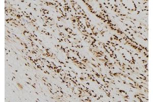 ABIN6267343 at 1/100 staining Human kidney tissue by IHC-P.