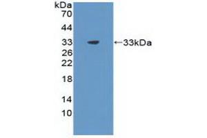 Western blot analysis of recombinant Rat CIDEC. (CIDEC 抗体  (AA 1-221))