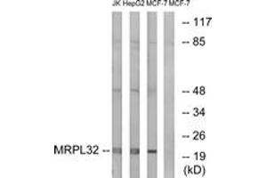 Western Blotting (WB) image for anti-Mitochondrial Ribosomal Protein L32 (MRPL32) (AA 101-150) antibody (ABIN2890054) (MRPL32 抗体  (AA 101-150))
