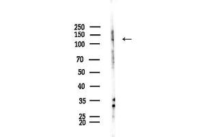 Western blot analysis of lysates from F10-LUC cells(starvation treatment), using ADAMTS10 Antibody at 1/1000 dilution.