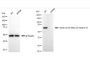 Western blotting analysis using Solute carrier family 25 member 12 antibody (ABIN7800390).