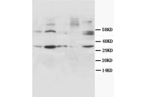 Western Blotting (WB) image for anti-Cyclin D1 (CCND1) antibody (ABIN1106872) (Cyclin D1 抗体)