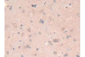 DAB staining on IHC-P; Samples: Rat Spinal cord Tissue (LAMB2 抗体  (AA 75-223))
