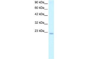 WB Suggested Anti-POLE3 Antibody Titration:  2. (POLE3 抗体  (N-Term))