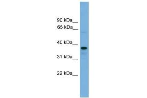 WB Suggested Anti-VPS16 Antibody Titration: 0. (VPS16 抗体  (N-Term))